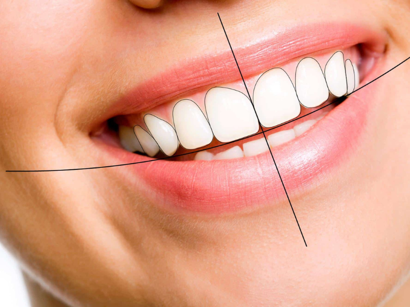 Digital Smile Designing