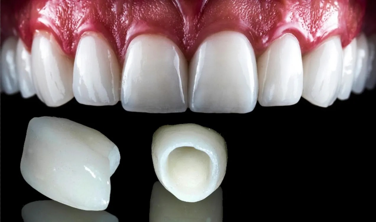  Zirconia Ceramic Crowns